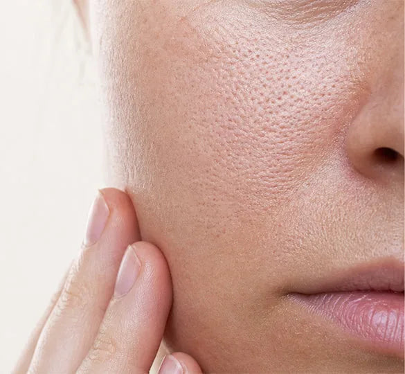 Why Are My Pores So Big? Causes and How to Make Them Look Smaller - Ariège Paris