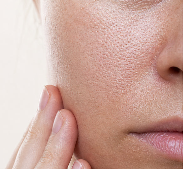 Pores