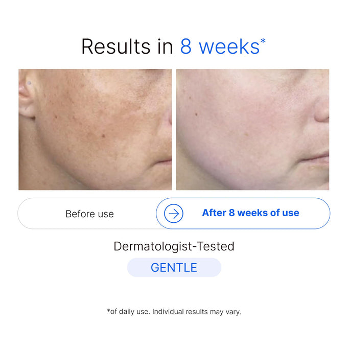 Sérum Unifiant – Correcteur de Taches Brunes