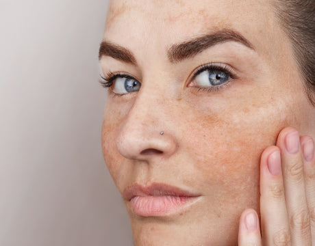 Dark spots & uneven tone