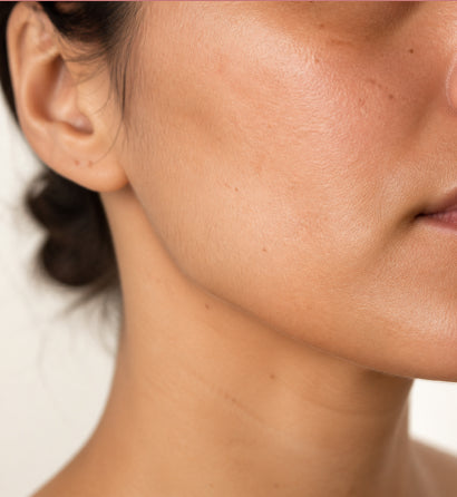 What Is Dull Skin?