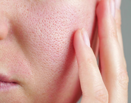 Visible pores